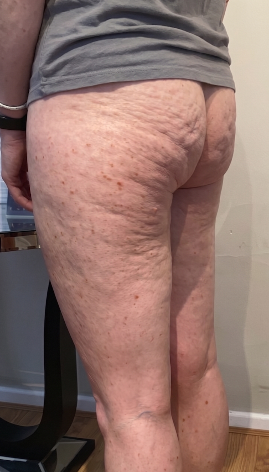 CalyraFit™ -  3D Anti-Cellulite & Lifting Legging